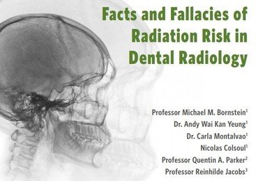 港大学者编制了一本小册子解释牙科检查辐射风险的事实和谬误