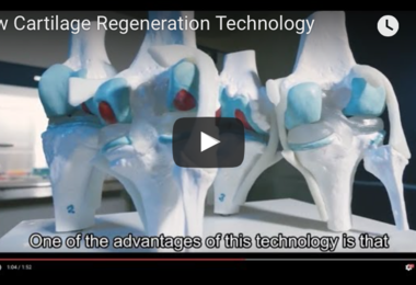 New Cartilage Regeneration Technology