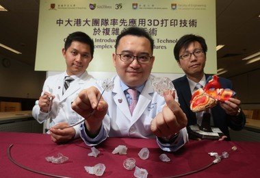 CUHK and HKU researchers introduce 3D printing technology in complex cardiac surgery procedures